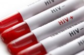بیماری ایدز و مراحل ابتلا به ویروس HIV چیست؟